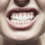 persona-molestias-mandibulares-apretar-dientes-durmiendo